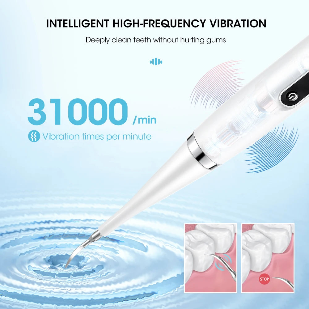 Cepillo de dientes sónico con raspador dental