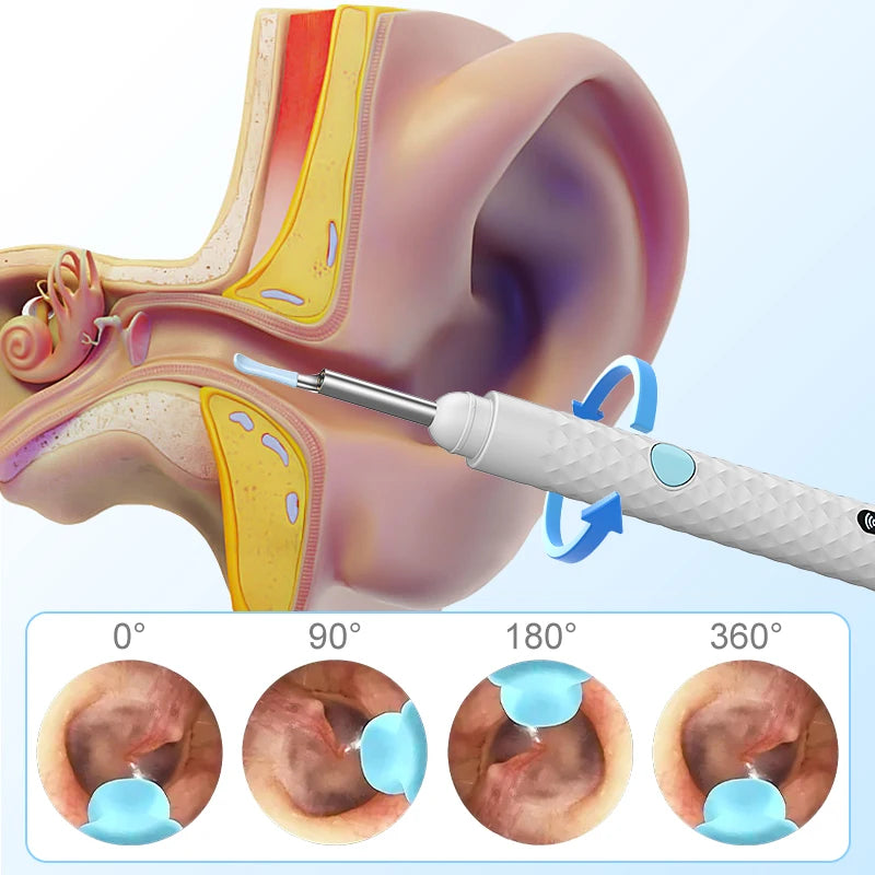 1080P Ear Scope  Ear Wax Cleaning Tool